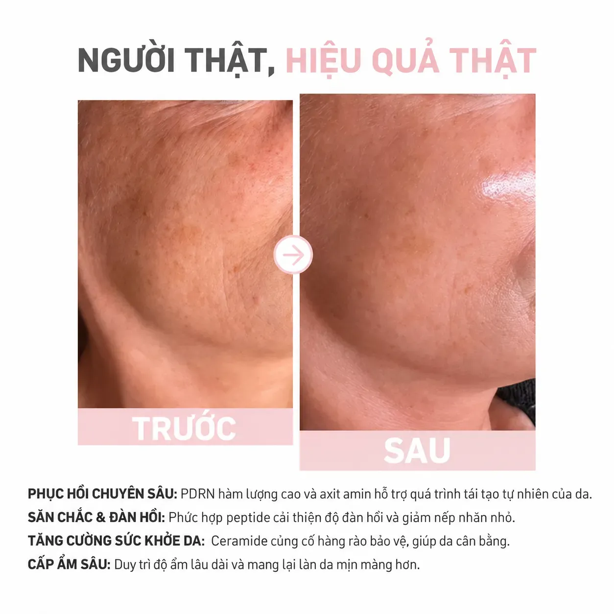 Nước Hoa Hồng Bionnex Salmon DNA PDRN Toner (200ml) Hover