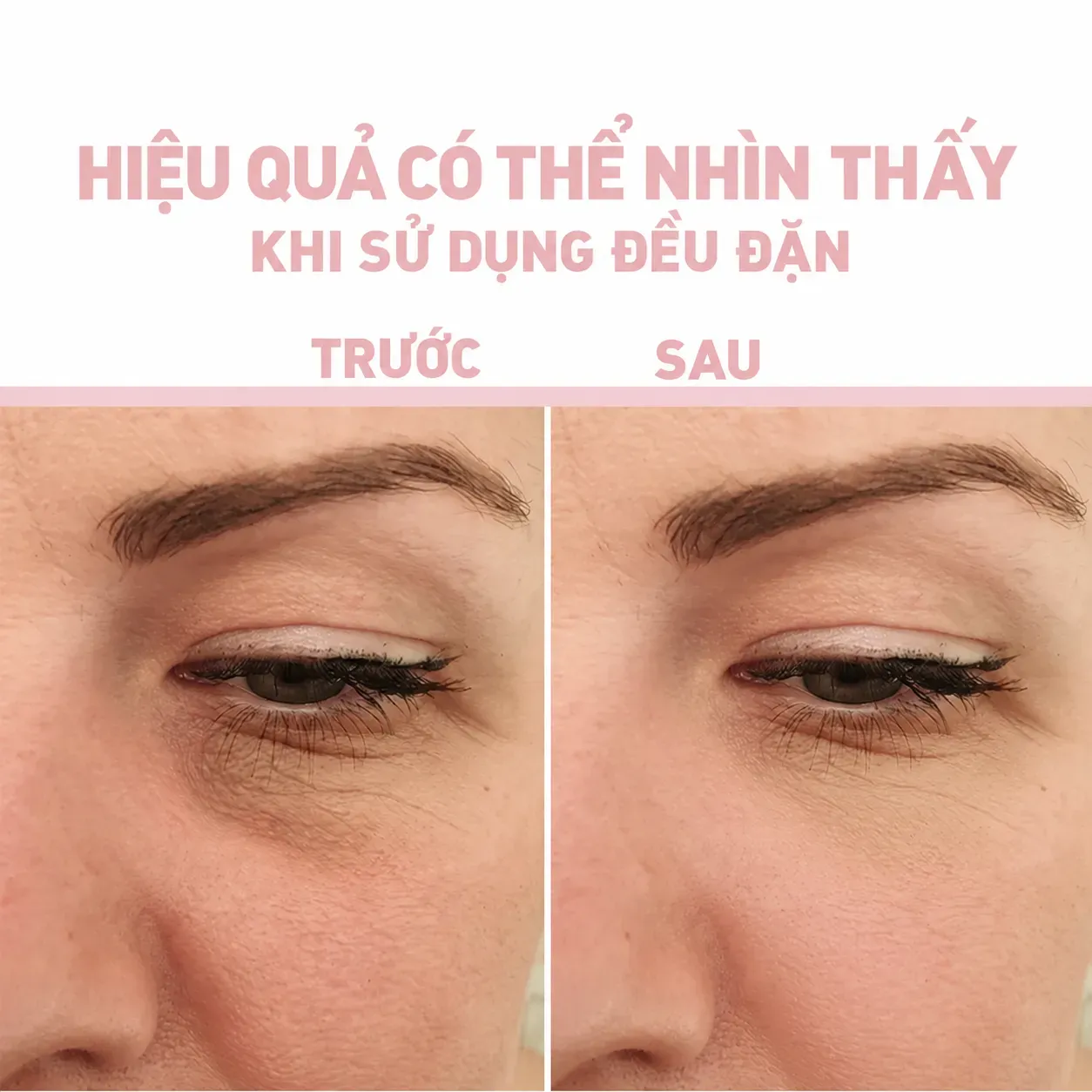 Ảnh thu nhỏ
