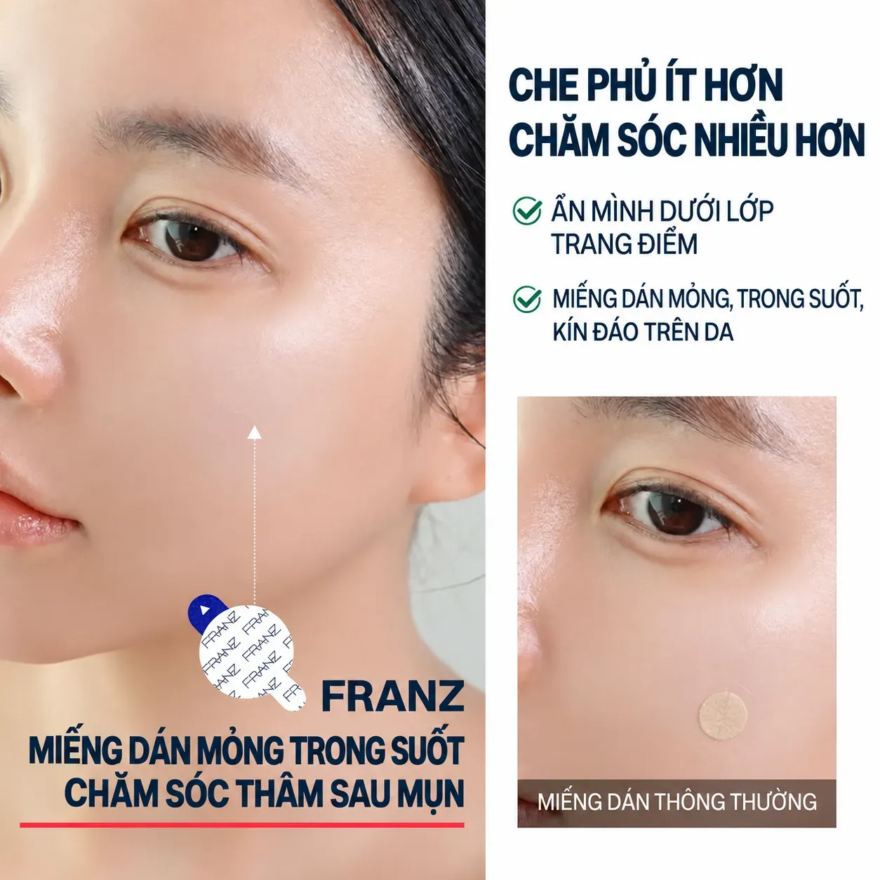 Ảnh thu nhỏ